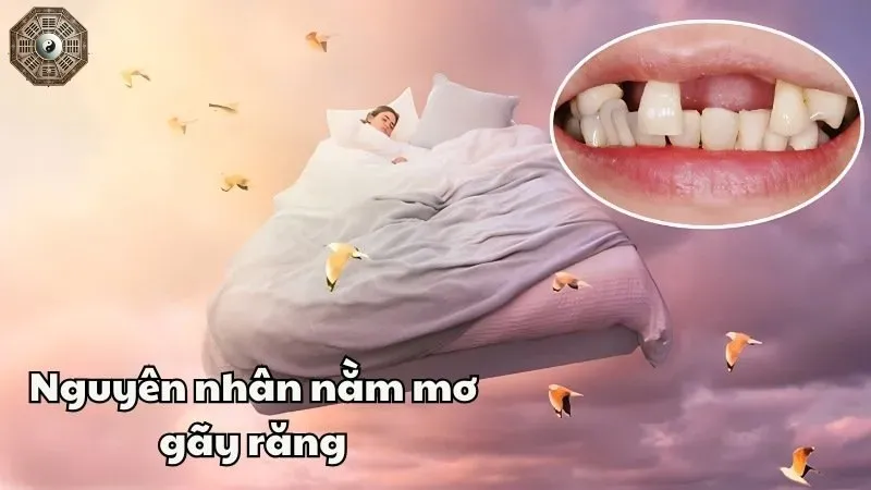 Mơ thấy gãy răng có ý nghĩa gì? Khám phá những điềm báo bí ẩn 1