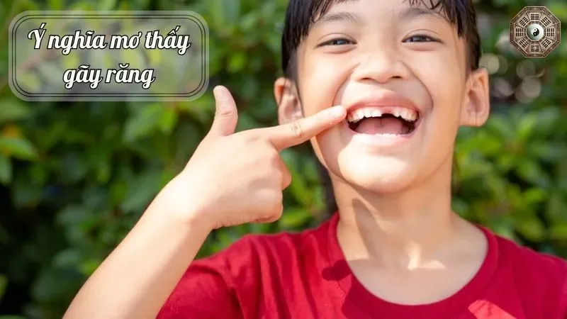 Mơ thấy gãy răng có ý nghĩa gì? Khám phá những điềm báo bí ẩn 3