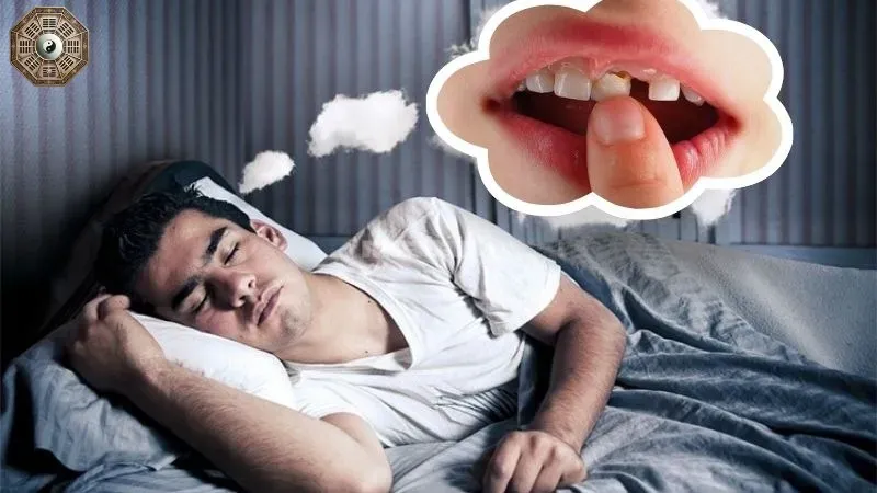 Mơ thấy gãy răng có ý nghĩa gì? Khám phá những điềm báo bí ẩn 6