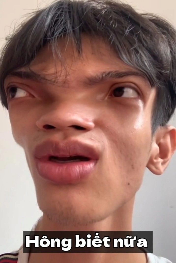 Hình ảnh meme avatar vô tri đáng yêu cho mạng xã hội