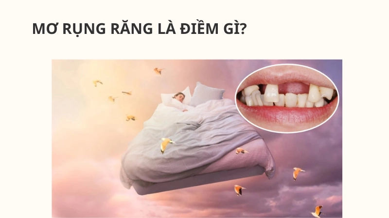 Giải mã giấc mơ thấy rụng răng báo hiệu điều gì